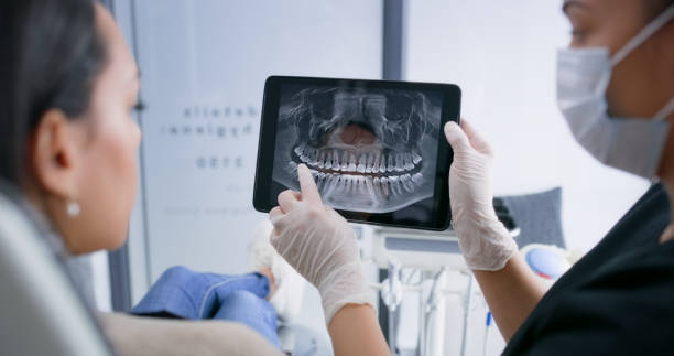 Licensed Teeth Whitening service in Warm Mineral Springs, FL - Smile Center Dentistry